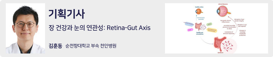 기획기사